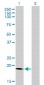 SSR4 Antibody (monoclonal) (M01)